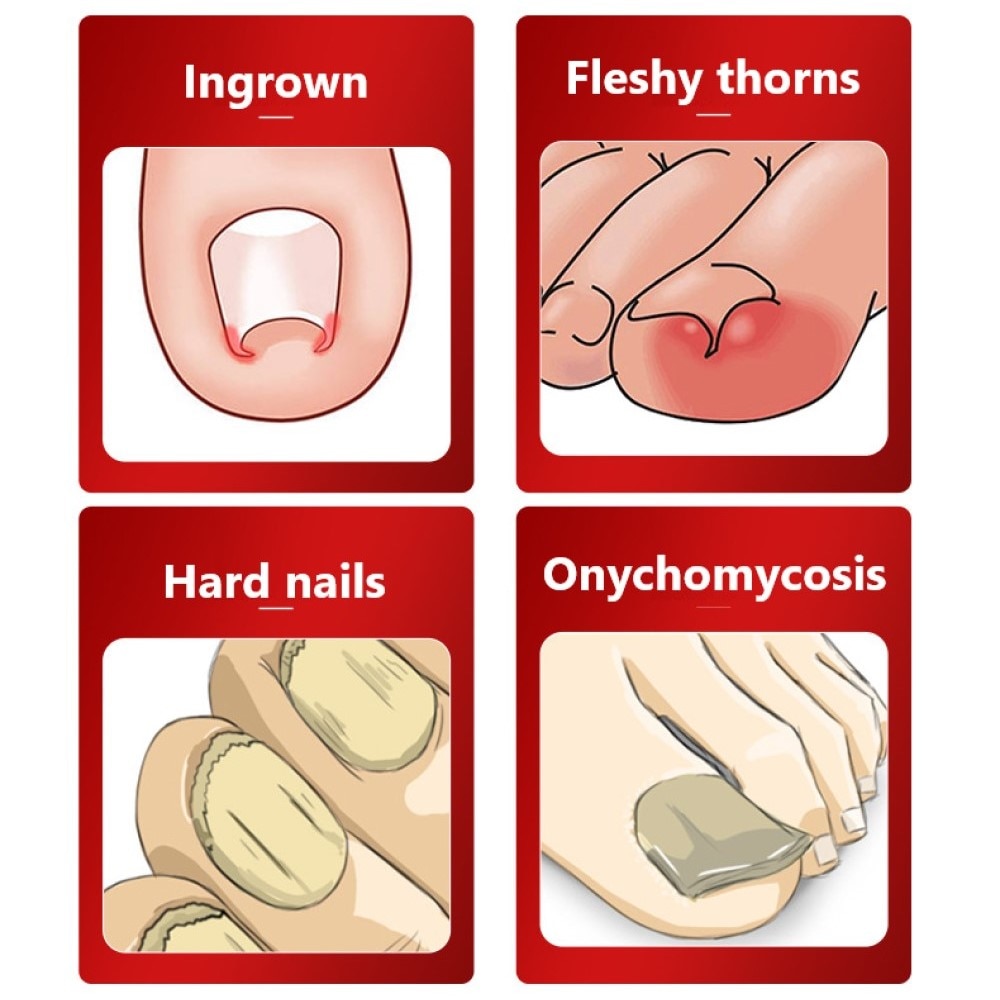 Dead Skin Dirt Remover Pedicure Care Tool Pro